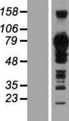 Western Blot: TJAP1 Overexpression Lysate (Adult Normal) [NBL1-16937] Left-Empty vector transfected control cell lysate (HEK293 cell lysate); Right -Over-expression Lysate for TJAP1.