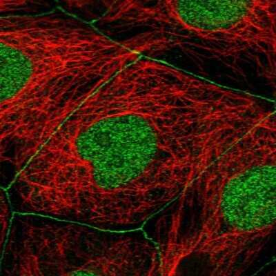 Immunocytochemistry/Immunofluorescence: TJP3 Antibody [NBP2-38696] - Staining  of human cell line CACO-2 shows positivity in cell junctions and nucleus but excluded from the nucleoli.