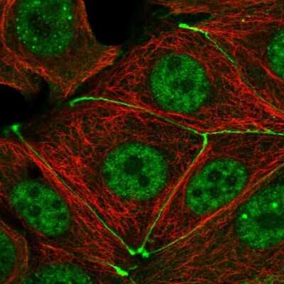 Immunocytochemistry/Immunofluorescence: TJP3 Antibody [NBP2-56794] - Staining of human cell line MCF7 shows localization to nucleoplasm & cell junctions.