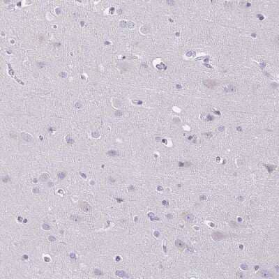 Immunohistochemistry-Paraffin: TJP3 Antibody [NBP2-38696] - Staining of human Cerebral cortex shows very weak membranous positivity in neuronal cells.