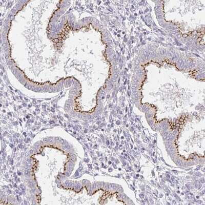 Immunohistochemistry-Paraffin: TJP3 Antibody [NBP2-38696] - Staining of human Endometrium shows strong membranous positivity in glandular cells.