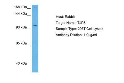 Western Blot: TJP3 Antibody [NBP2-85921] - Host: Rabbit. Target Name: TJP3. Sample Tissue: Human 293T Whole Cell lysates. Antibody Dilution: 2ug/ml