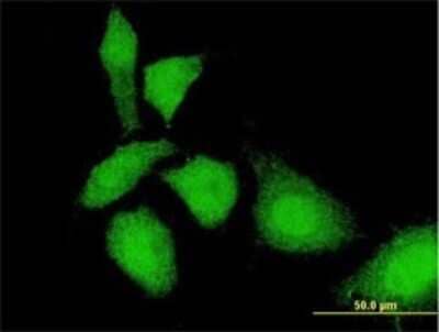 Immunocytochemistry/Immunofluorescence: TKTL1 Antibody (1C10) [H00008277-M01] - Analysis of monoclonal antibody to TKTL1 on HeLa cell . Antibody concentration 10 ug/ml.