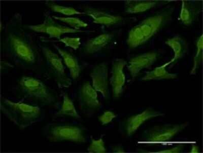 Immunocytochemistry/Immunofluorescence: TKTL1 Antibody (1D6) [H00008277-M02] - Analysis of monoclonal antibody to TKTL1 on HeLa cell . Antibody concentration 15 ug/ml.