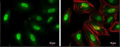 Immunocytochemistry/Immunofluorescence: TKTL1 Antibody [NBP1-31674] - HeLa cells were fixed in 4% paraformaldehyde at RT for 15 min. Green: TKTL1 protein stained by TKTL1 antibody [N1C1] diluted at 1:500. Red: Phalloidin, a cytoskeleton marker, diluted at 1:100. Scale bar = 10 um.