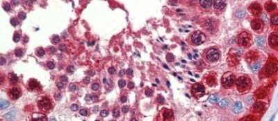 Immunohistochemistry-Paraffin: TKTL1 Antibody [NBP1-54864] - Human Testis Tissue, 5.0ug/ml.