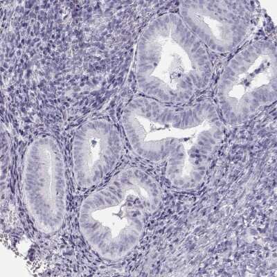 Immunohistochemistry-Paraffin: TKTL1 Antibody [NBP1-86939] - Staining of human endometrium shows low expression as expected.