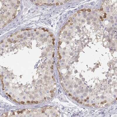 Immunohistochemistry-Paraffin TKTL1 Antibody