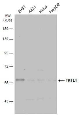 Western Blot: TKTL1 Antibody [NBP1-31674] - Various whole cell extracts (30 ug) were separated by 7.5% SDS-PAGE, and the membrane was blotted with TKTL1 antibody [N1C1] diluted at 1:5000. The HRP-conjugated anti-rabbit IgG antibody (NBP2-19301) was used to detect the primary antibody.