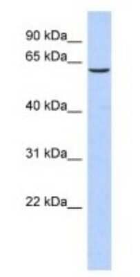 Western Blot: TKTL1 Antibody [NBP1-54864] - Human Fetal Stomach Cell Lysate, concentration 1 ug/ml.