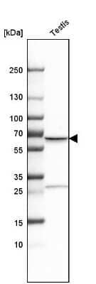 Western Blot: TKTL1 Antibody [NBP1-86939] - Analysis in human testis tissue.