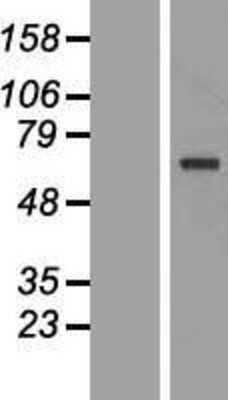 Western Blot: TKTL1 Overexpression Lysate (Adult Normal) [NBL1-16941] Left-Empty vector transfected control cell lysate (HEK293 cell lysate); Right -Over-expression Lysate for TKTL1.