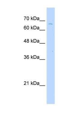 Western Blot: TKTL2 Antibody [NBP1-55173] - Jurkat cell lysate, concentration 2.5 ug/ml.