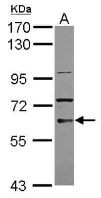 Western Blot: TKTL2 Antibody [NBP2-20649] - Sample (30 ug of whole cell lysate) A: 293T 7. 5% SDS PAGE gel, diluted at 1:1000.