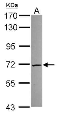 Western Blot TKTL2 Antibody