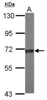 Western Blot TKTL2 Antibody