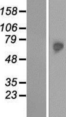 Western Blot: TKTL2 Overexpression Lysate (Adult Normal) [NBP2-06075] Left-Empty vector transfected control cell lysate (HEK293 cell lysate); Right -Over-expression Lysate for TKTL2.