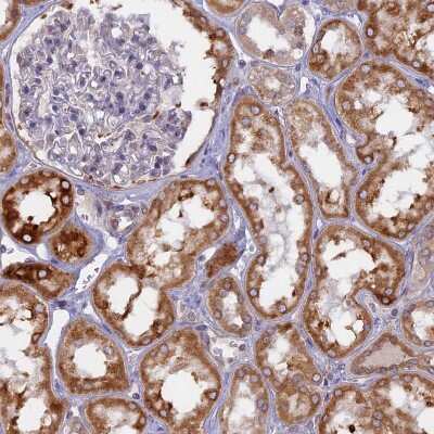 Immunohistochemistry-Paraffin: TLCD1 Antibody [NBP1-85834] - Staining of human kidney shows moderate cytoplasmic positivity in cells in tubules.
