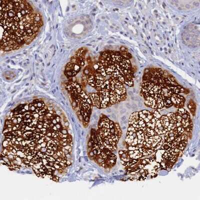 Immunohistochemistry-Paraffin: TLCD1 Antibody [NBP1-85834] - Staining of human skin shows strong cytoplasmic positivity in sebaceous gland.