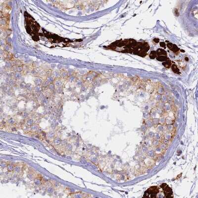 Immunohistochemistry-Paraffin: TLCD1 Antibody [NBP1-85834] - Staining of human testis shows strong cytoplasmic positivity in Leydig cells.