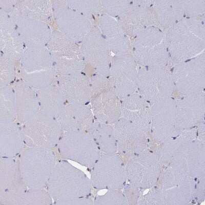 Immunohistochemistry-Paraffin: TLCD1 Antibody [NBP1-85834] - Staining of human skeletal muscle shows no positivity in myocytes as expected.