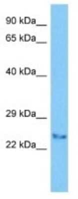 Western Blot: TLCD3A Antibody [NBP3-10084] - Western blot analysis of TLCD3A in Human Jurkat Whole Cell lysates. Antibody dilution at 1ug/ml