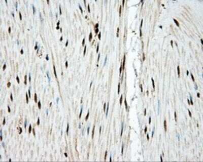 Immunohistochemistry: TLDC1 Antibody (OTI5D9) - Azide and BSA Free [NBP2-72091] - Staining of paraffin-embedded colon tissue using anti-KIAA1609 mouse monoclonal antibody.