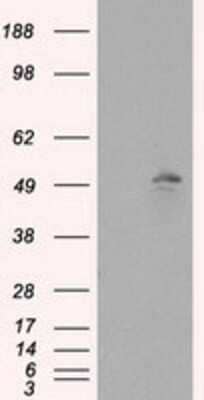 Western Blot: TLDC1 Antibody (OTI5D9) - Azide and BSA Free [NBP2-72091] - HEK293T cells were transfected with the pCMV6-ENTRY control (Left lane) or pCMV6-ENTRY KIAA1609 (Right lane) cDNA for 48 hrs and lysed. Equivalent amounts of cell lysates (5 ug per lane) were separated by SDS-PAGE and immunoblotted with anti-KIAA1609.