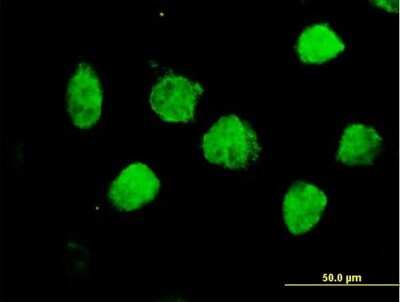 Immunocytochemistry/Immunofluorescence: TLE1 Antibody [H00007088-B01P] - Analysis of purified antibody to TLE1 on HeLa cell. (antibody concentration 10 ug/ml)