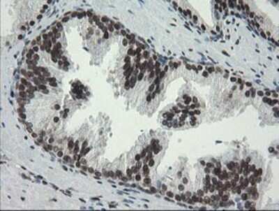 Immunohistochemistry: TLE1 Antibody (OTI1H2) [NBP2-46134] - Analysis of Human prostate tissue.