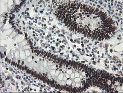 Immunohistochemistry: TLE1 Antibody (OTI1H2) [NBP2-46134] - Analysis of Human colon tissue.