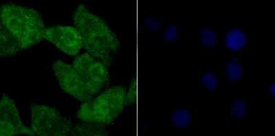 Immunocytochemistry/Immunofluorescence: TLE6 Antibody [NBP2-75684] - Staining Tle6 in A549 cells (green). The nuclear counter stain is DAPI (blue). Cells were fixed in paraformaldehyde, permeabilised with 0.25% Triton X100/PBS.
