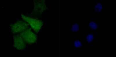 Immunocytochemistry/Immunofluorescence: TLE6 Antibody [NBP2-75684] - Staining Tle6 in SK-Br-3 cells (green). The nuclear counter stain is DAPI (blue). Cells were fixed in paraformaldehyde, permeabilised with 0.25% Triton X100/PBS.