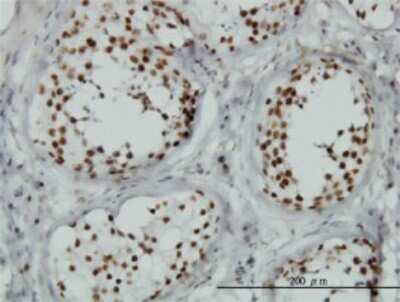 Immunohistochemistry-Paraffin: TLK1 Antibody (4B3) [H00009874-M01] - Analysis of monoclonal antibody to TLK1 on formalin-fixed paraffin-embedded human testis. Antibody concentration 1 ug/ml.