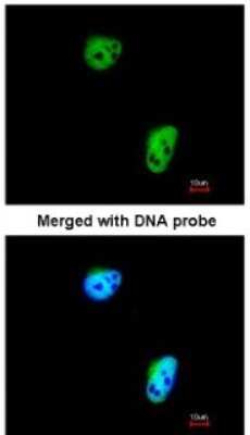 Immunocytochemistry/Immunofluorescence: TLK1 Antibody [NBP1-32354] - Paraformaldehyde-fixed HeLa, using antibody at 1:200 dilution.