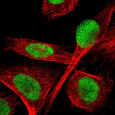 Immunocytochemistry/Immunofluorescence: TLK1 Antibody [NBP1-83035] - Immunofluorescent staining of human cell line U-251 MG shows localization to nucleus.