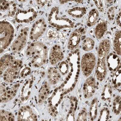 Immunohistochemistry-Paraffin: TLK1 Antibody [NBP1-83035] - Staining of human kidney shows strong nuclear and slightly weaker cytoplasmic positivity in tubules and glomeruli.