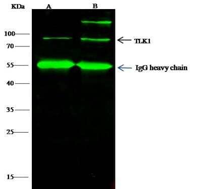 Immunoprecipitation: TLK1 Antibody [NBP2-98826] - Lane A:0.5 mg 293T Whole Cell LysateLane B:0.5 mg K562 Whole Cell Lysate4 uL anti-TLK1 rabbit polyclonal antibody and 60 ug of Immunomagnetic beads Protein G.Primary antibody:Anti-TLK1 rabbit polyclonal antibody,at 1:100 dilutionSecondary antibody:Dylight 800-labeled antibody to rabbit IgG (H+L), at 1:5000 dilutionDeveloped using the odssey technique.Performed under reducing conditions.Predicted band size: 87 kDaObserved band size: 87 kDa