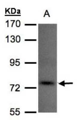 Western Blot: TLK1 Antibody [NBP1-32354] - Sample(30 ug of whole cell lysate)A:293T 7. 5% SDS PAGE, antibody diluted at 1:500.