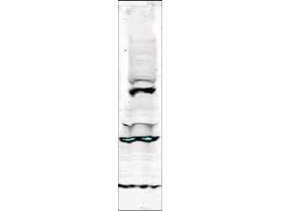 Western Blot: TLK1 Antibody [NBP1-77982] - Shows detection of a band ~64 kDa corresponding to isoform 3 of human Tlk-1 (arrowhead). Specific reactivity with this band is blocked when the antibody is pre-incubated with the immunizing peptide (data not shown). Approximately 30 ug of a HeLa nuclear extract was separated by SDS-PAGE and transferred onto nitrocellulose. After blocking the membrane was probed with the primary antibody diluted to 1:250 for 2h at room temperature followed by washes and reaction with a 1:10,000 dilution of IRDye 800 conjugated Gt-a-Rabbit IgG [H&L] MX for 45 min at room temperature.