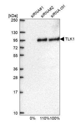 Western Blot TLK1 Antibody