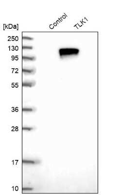 Western Blot: TLK1 Antibody [NBP1-83035] - Analysis in control (vector only transfected HEK293T lysate) and TLK1 over-expression lysate (Co-expressed with a C-terminal myc-DDK tag (3.1 kDa) in mammalian HEK293T cells).