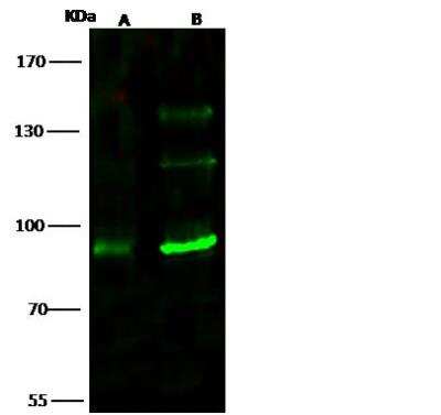 Western Blot: TLK1 Antibody [NBP2-98826] - Lane A: 293T Whole Cell LysateLane B: K562 Whole Cell LysateLysates/proteins at 30 ug per lane.SecondaryGoat Anti- Rabbit  IgG H&L (Dylight 800)  at 1/10000 dilution.Developed using the Odyssey technique.Performed under reducing conditions.Predicted band size:87 kDaObserved band size:87 kDa(We are unsure as to the identity of these extra bands.)