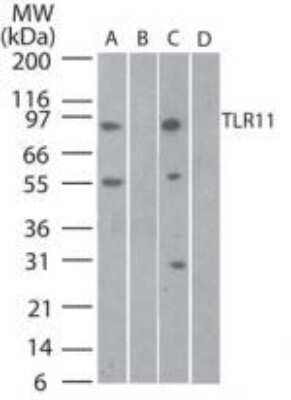 Western Blot: TLR11 Antibody [NB100-56742] - WB analysis of TLR11 in mouse testis lysate in A) the absence and B) presence of blocking peptide and rat testis lysate in C) the absence and D) presence of blocking peptide using at 3 ug/ml.