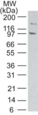 Western Blot: TLR11 Antibody [NB100-56742] - Western blot analysis of TLR11 in mouse RAW cell lysate using TLR11 antibody at 2 ug/ml.