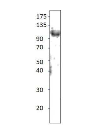 Western Blot: TLR11 Antibody [NBP3-12500] - 1:500 antibody dilution in DiluObuffer.