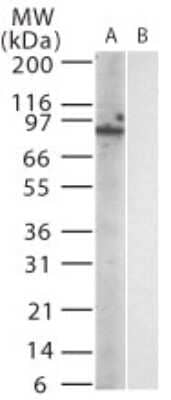 Western Blot: TLR12 Antibody (15F1215) [NBP2-24870] - Analysis of mouse TLR12 in (A) transfected and (B) untransfected cell lysate using this antibody at 1:1000.