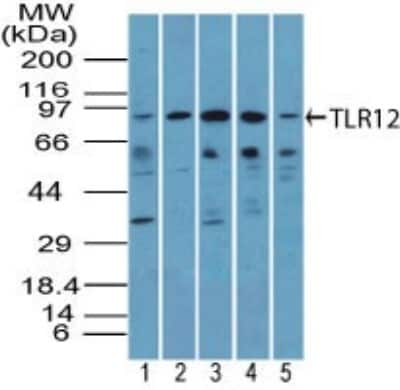 Western Blot: TLR12 Antibody [NBP2-24833] - Analysis of TLR12 in male rat reproductive tissue: 1) whole testis, 2) caput, 3) corpus, 4) cauda and 5) vas deferens using this antibody at 4 ug/ml.