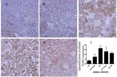 Immunohistochemistry: TLR2 Antibody - Azide Free [NBP2-24861] - Representative photographs of immunohistochemistry for tubular TLR2 in G) ctrl, H) ctrl + empa, I) diabetic (dm), J) dm + empagliflozin, K) dm + telmisartan groups (Magnification = original X 200) and quantification of tubular TLR2 expression by Image J (L). (Data are expressed as mean +/- SEM with *=P<0.05 vs ctrl, **=P<0.001 vs ctrl and #=P<0.05 vs dm). Image collected and cropped by CiteAb from the following publication (//doi.org/10.1371/journal.pone.0108994) licensed under a CC-BY license. Image using the standard format of this product.