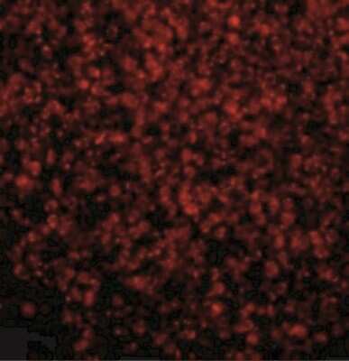 Immunohistochemistry: TLR2 Antibody [NBP1-77229] - Immunofluorescence of TLR2 in Human Spleen tissue with TLR2 antibody at 10 ug/mL.